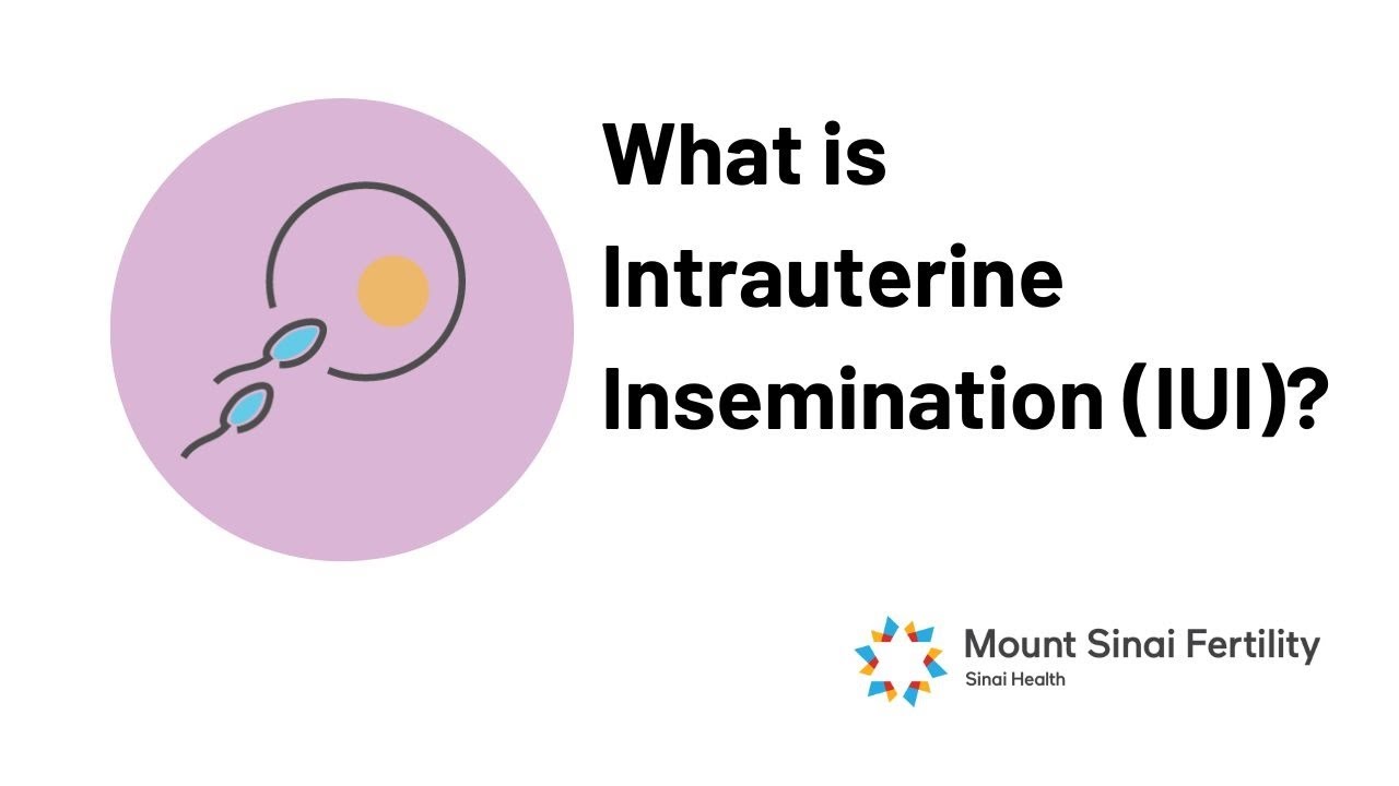 Intrauterine Insemination