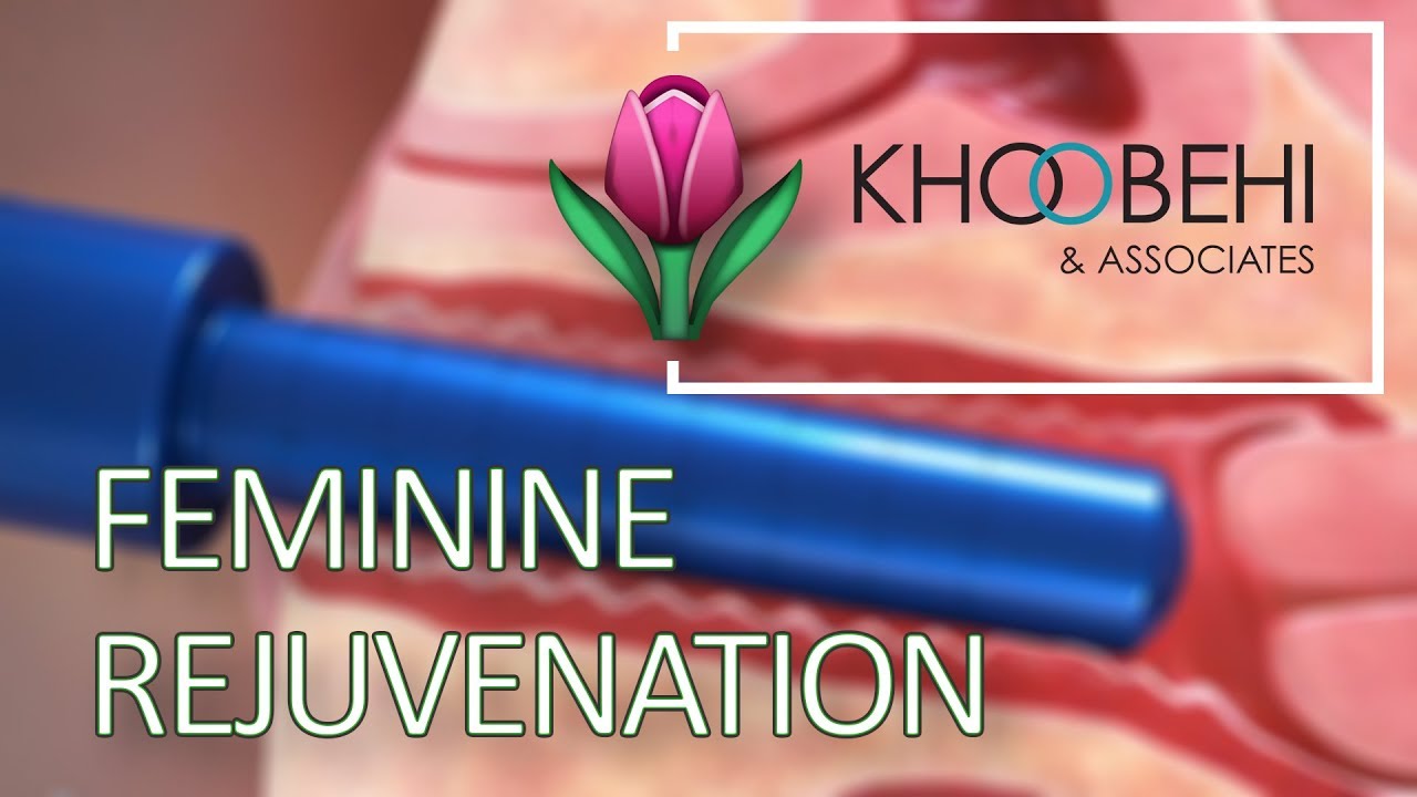 Feminine Rejuvenation Procedures | Non-surgical and Surgical Methods |  Everything you need to know!
