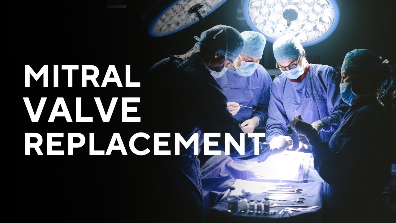 Transcatheter Mitral Valve Replacement (TMVR) | Prof David Muller