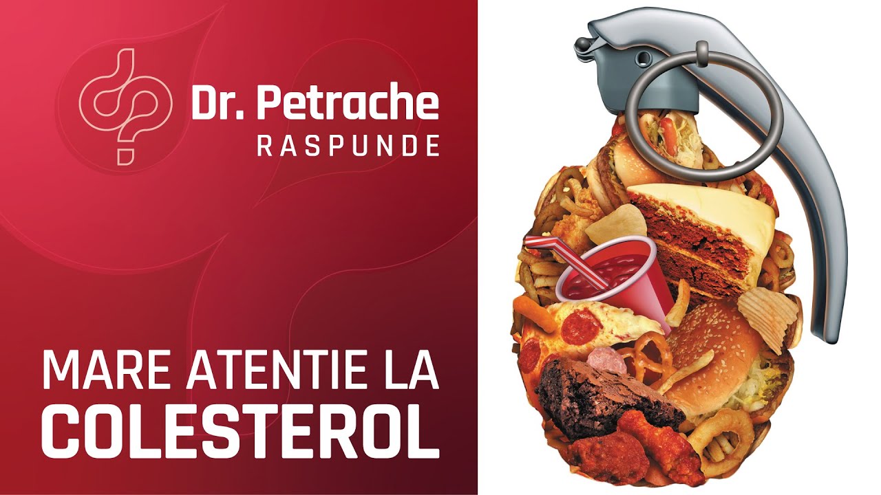 FERESTE-TE DE ACESTE ALIMENTE DACA AI COLESTEROLUL MARE