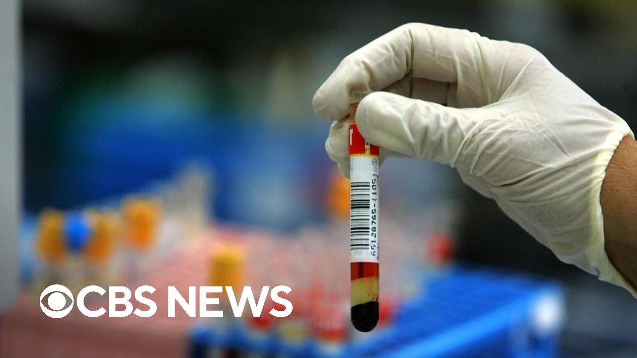 New blood test to detect colon cancer approved by FDA