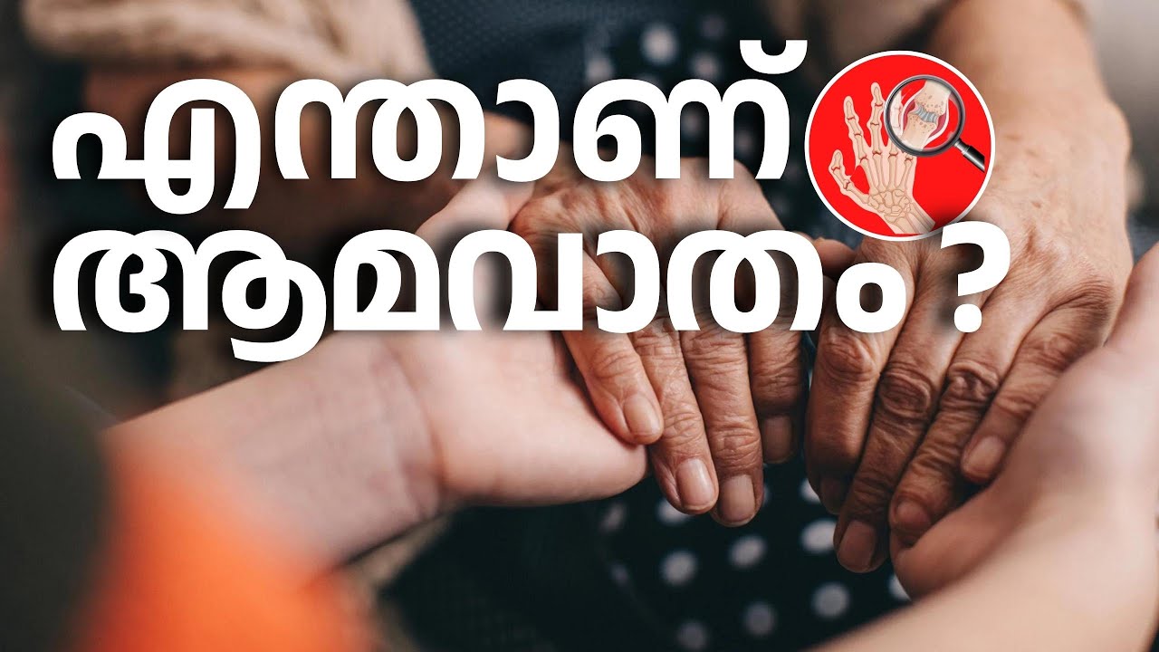 എന്താണ് ആമവാതം? ;അറിയേണ്ടതെല്ലാം| ആദ്യ ലക്ഷണങ്ങൾ? | ചികിത്സ? | Rheumatoid Arthritis | Video #31