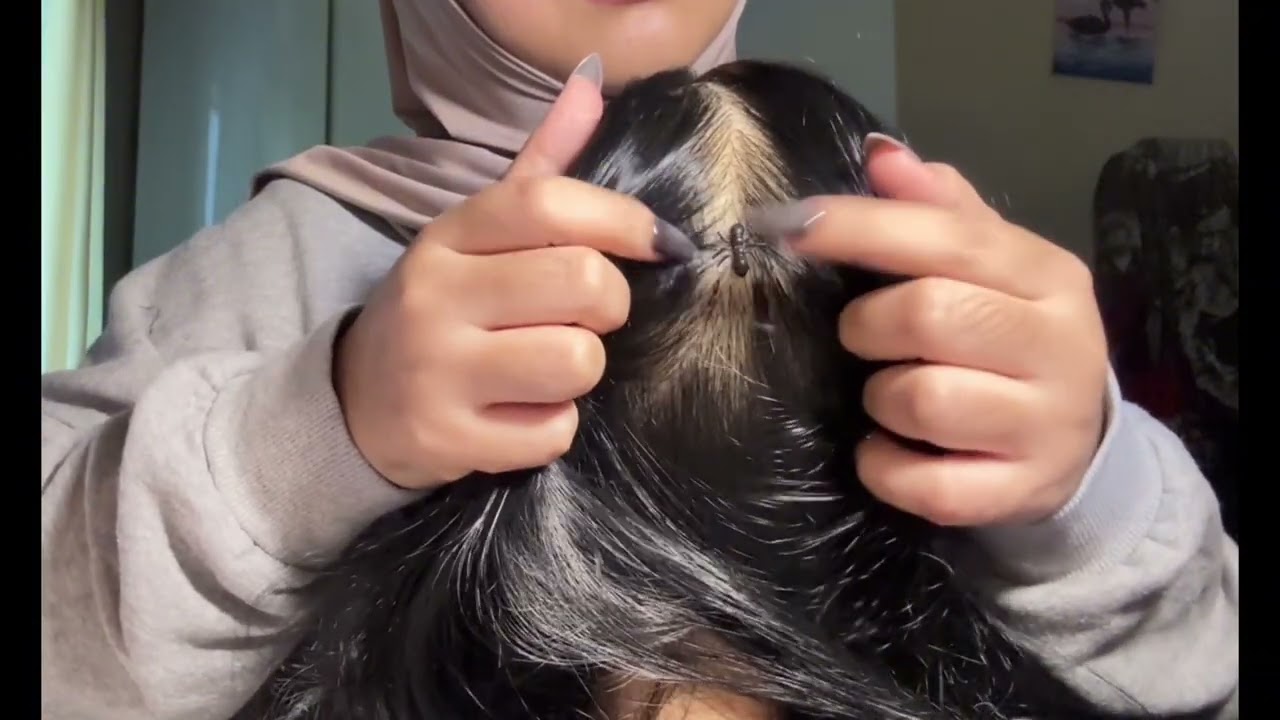ASMR Aggressive Lice Check And Hair Scratching