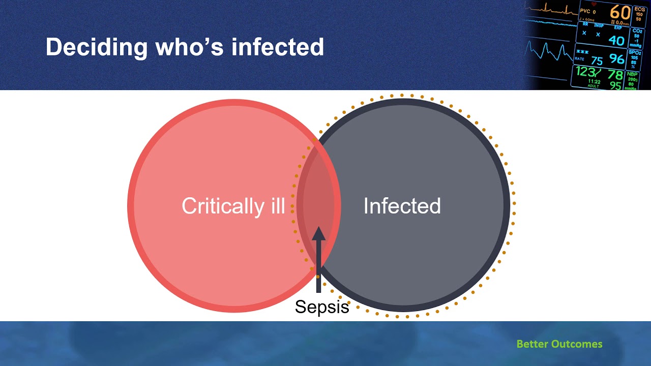 Beyond SIRS Rethinking Sepsis Screening in the Hospital