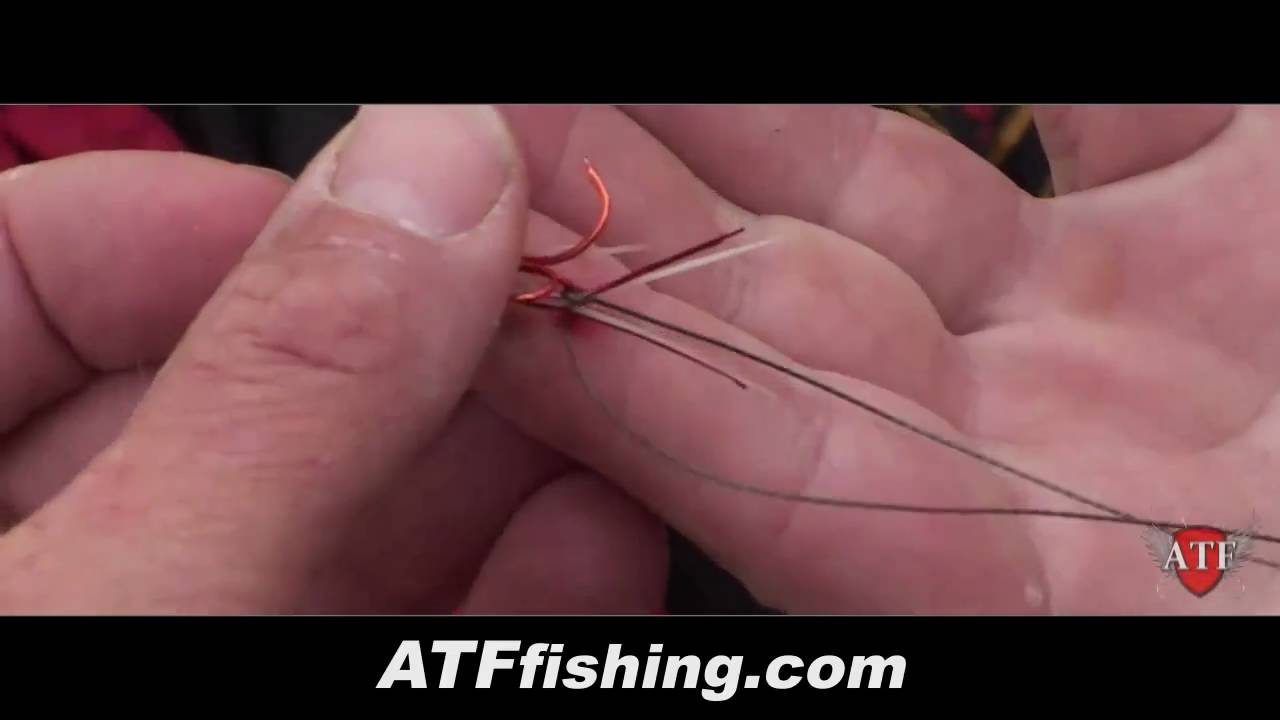 How To Remove A Hook From Finger (REAL FOOTAGE!)