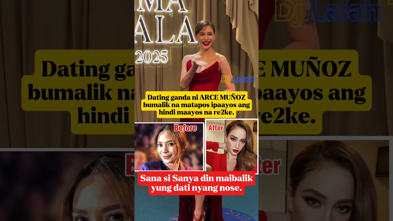 I AM HAPPY TO SEE YOUR BEAUTY AGAIN ARCI MU&Ntilde;OZ #shorts