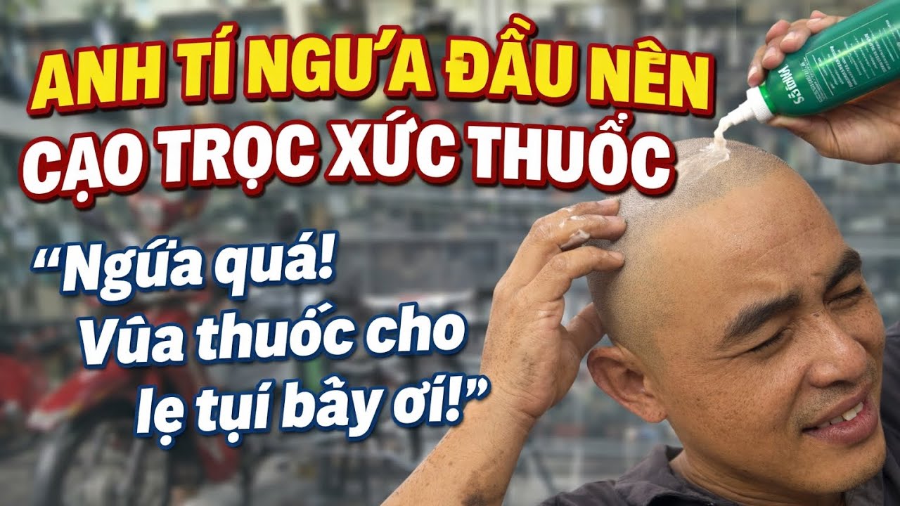 🤣 Cao Trọc Để Hết Ngứa! Anh Tý Liều Mình Và Cái Kết Cười Ra Nước Mắt