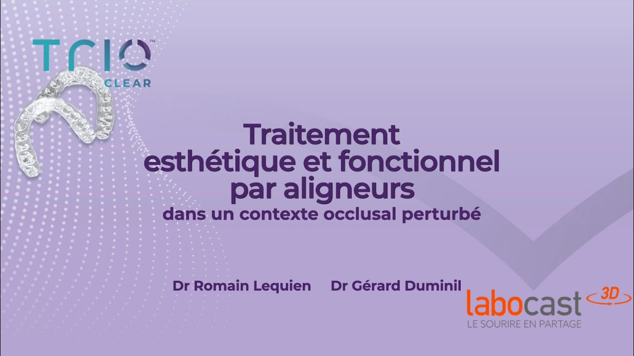 Cas complexe : comment les aligneurs corrigent esthétique et fonction ?