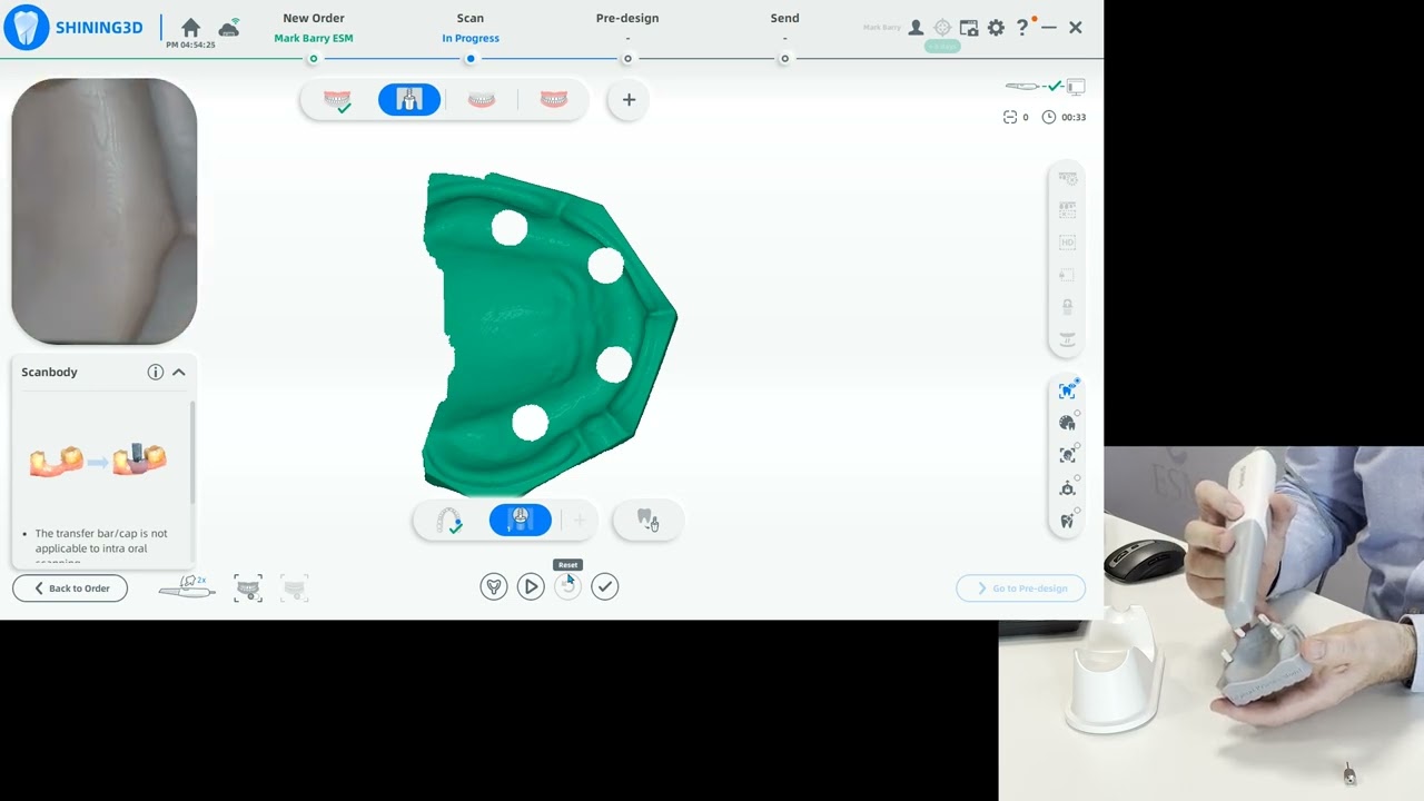 Full Arch Dental Scanning Workflow with Conventional Scan Body