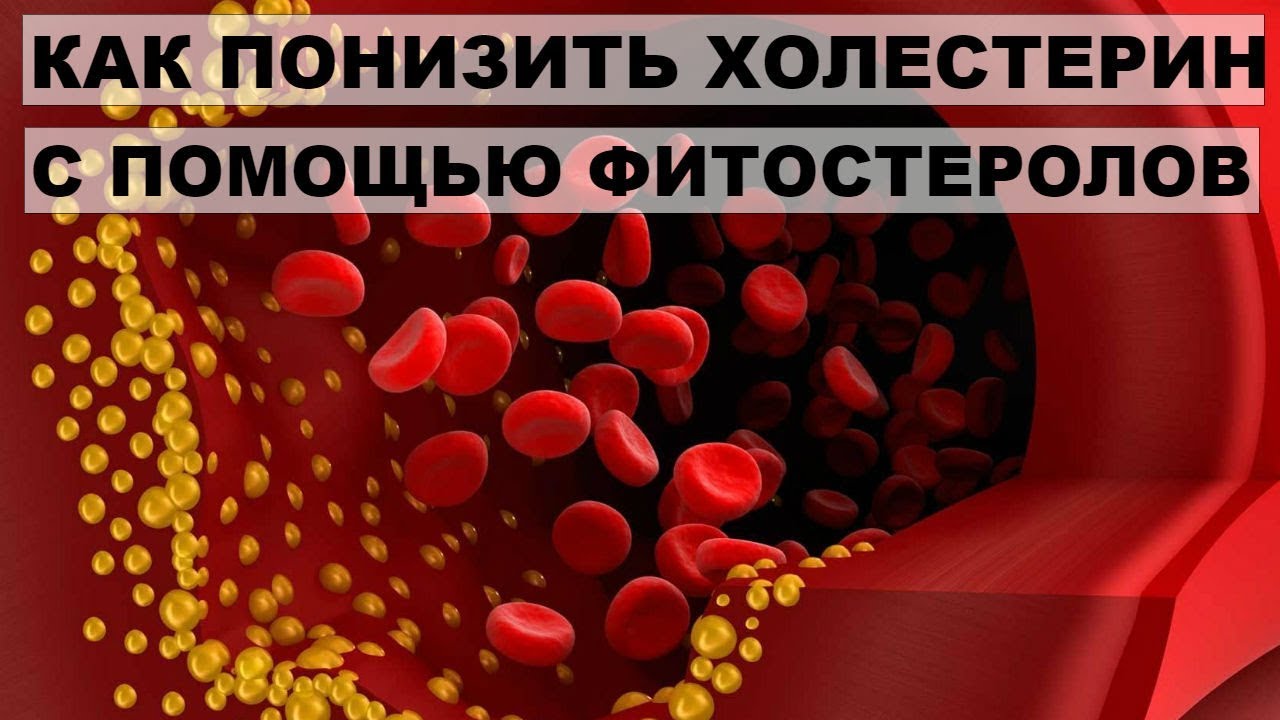 КАК ПОНИЗИТЬ ХОЛЕСТЕРИН С ПОМОЩЬЮ ФИТОСТЕРОЛОВ. В каких продуктах содержатся фитостеролы