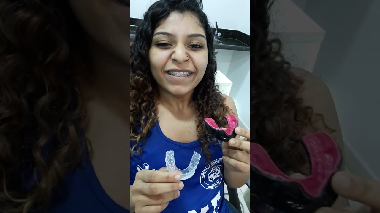 Protetores Bucais para atleta com aparelho ortodôntico superior e inferior - Dr Luiz Carvalho