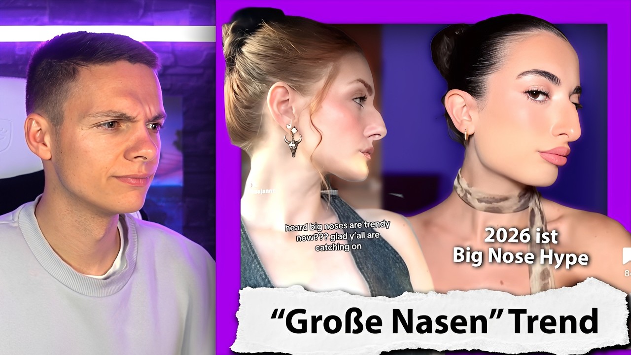 Große Nasen sind jetzt Trend & wir feiern es nicht