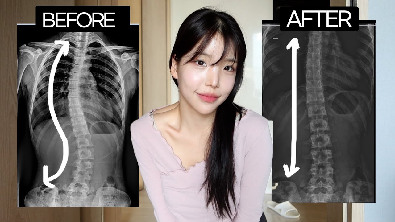 Sub 내가 '호흡'으로 척추교정한방법 얼굴비대칭 고민이라면 꼭 보세요.