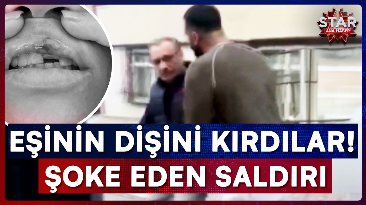İkiz Bebeklerinin ve Eşinin Yanında Şoke Eden Saldırı | Star Ana Haber