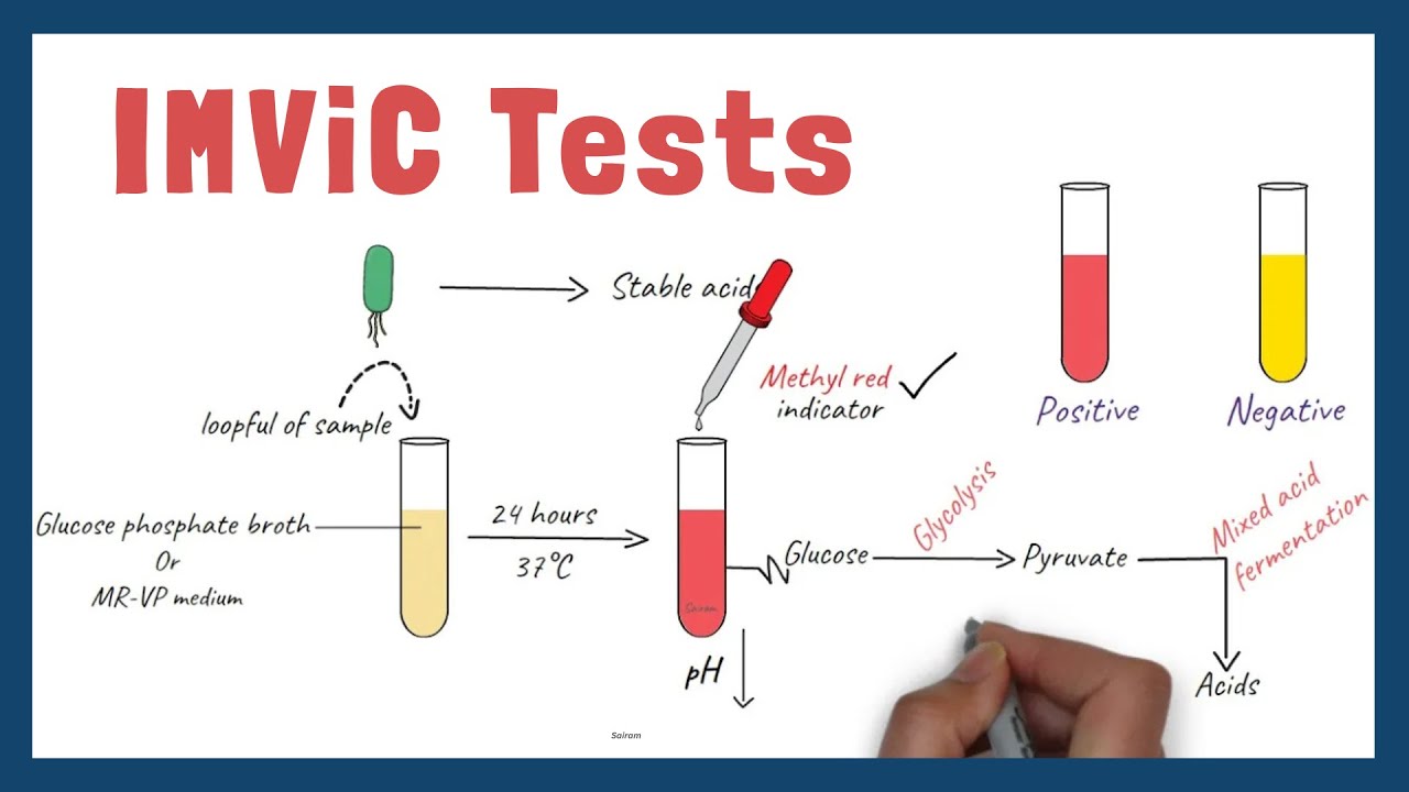 IMViC Tests |  Procedure and Principle | Microbiology