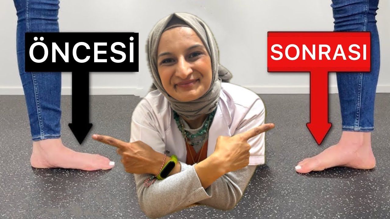 Diz Ağrısının Nedeni DÜZ TABANLIK! - Evde DÜZ TABANLIK Problemini Düzelt!   #fizyoterapistmacide