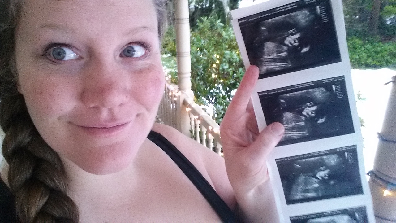 20 week Anatomy Scan/Ultrasound:  Find out how it went and what we are having!