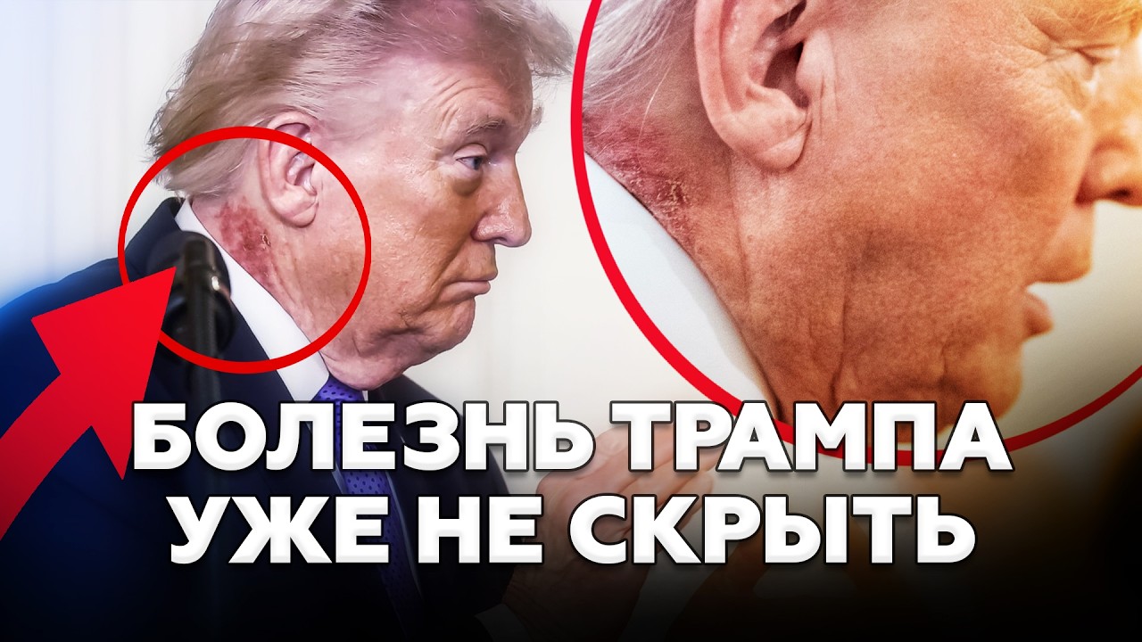 😱Слили ЖУТКИЕ кадры! Что это НА ШЕЕ у Трампа? Журналистам строго ЗАПРЕТИЛИ это снимать!