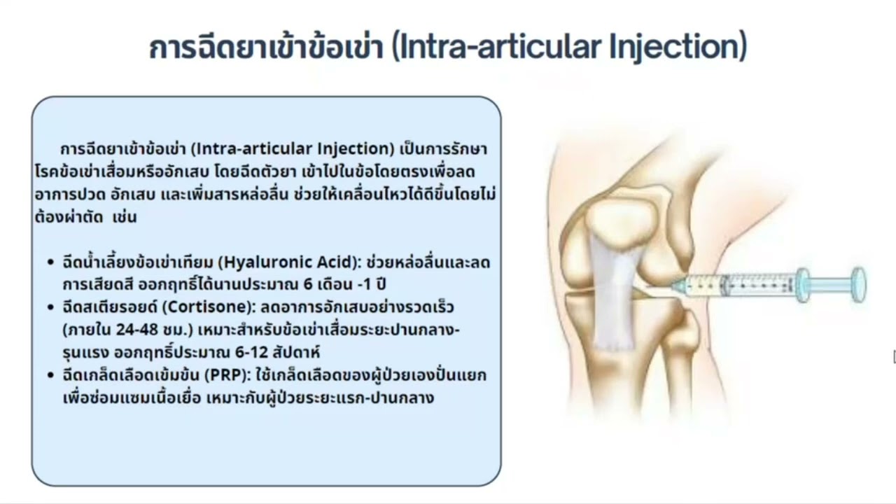 Strategic Product Ortho