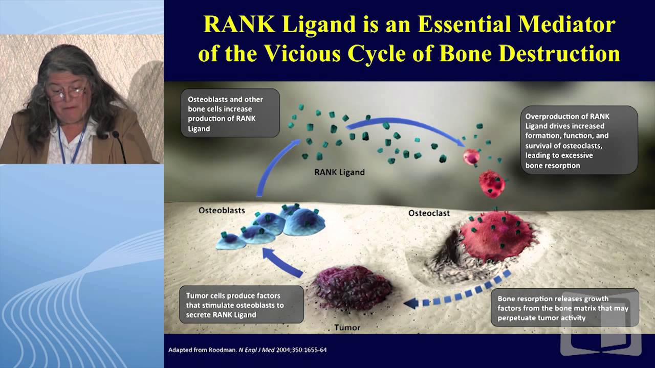 Bisphosphonates vs. RANK ligand inhibition in bone metastases