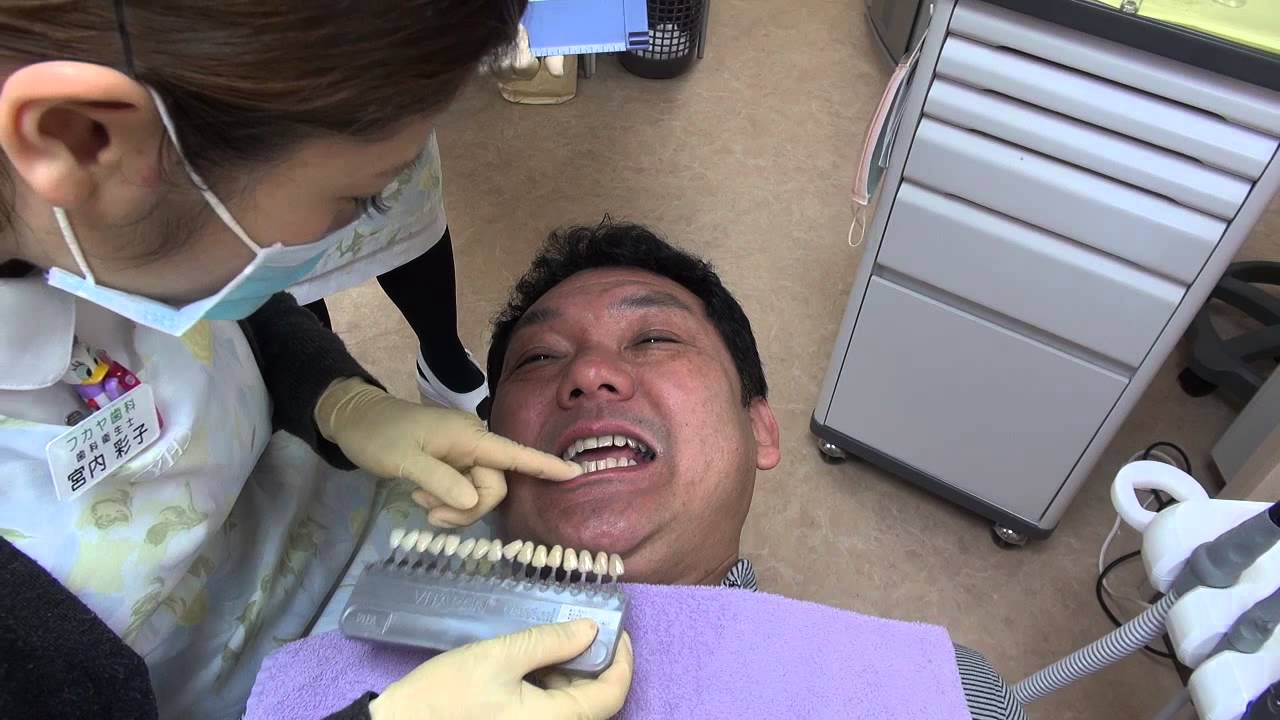 茨城県水戸市フカヤ歯科ポリリンホワイトニング体験男性5
