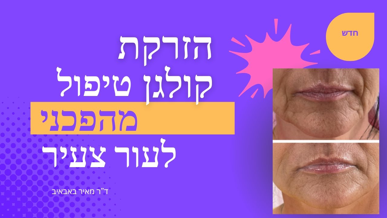 הזרקת קולגן לפנים צוואר וידיים