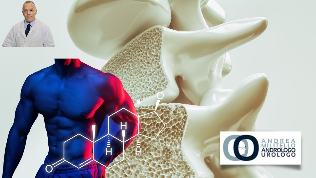 Osteoporosi e bassi livelli di testosterone
