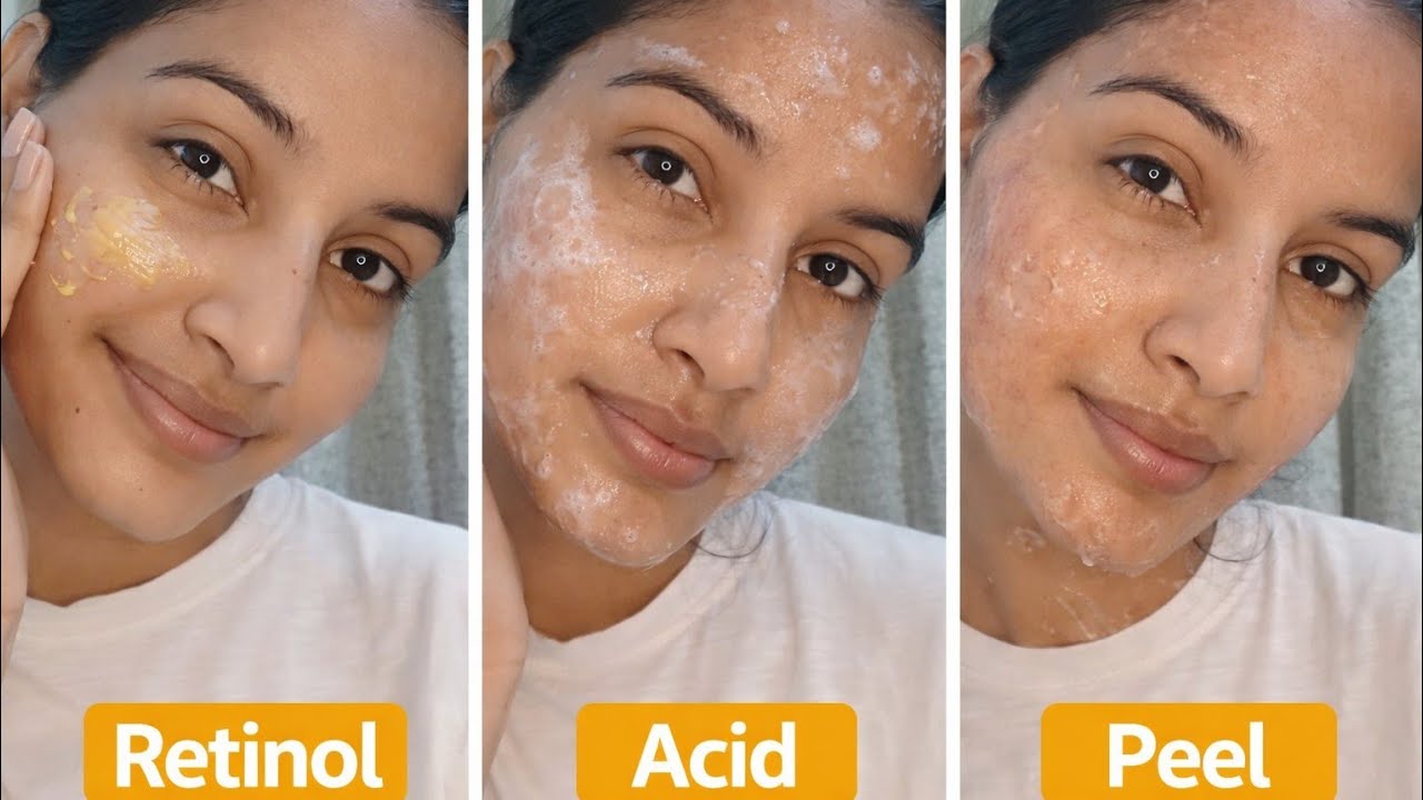“Retinol, Acid, Peel – Ye Galti Kar Li To Skin Barbaad Ho Jayegi | Brutally Honest”