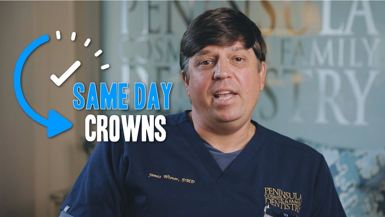 Charleston Dental Crowns | Same-Day Dental Crown Benefits | Peninsula Cosmetic & Family Dentistry