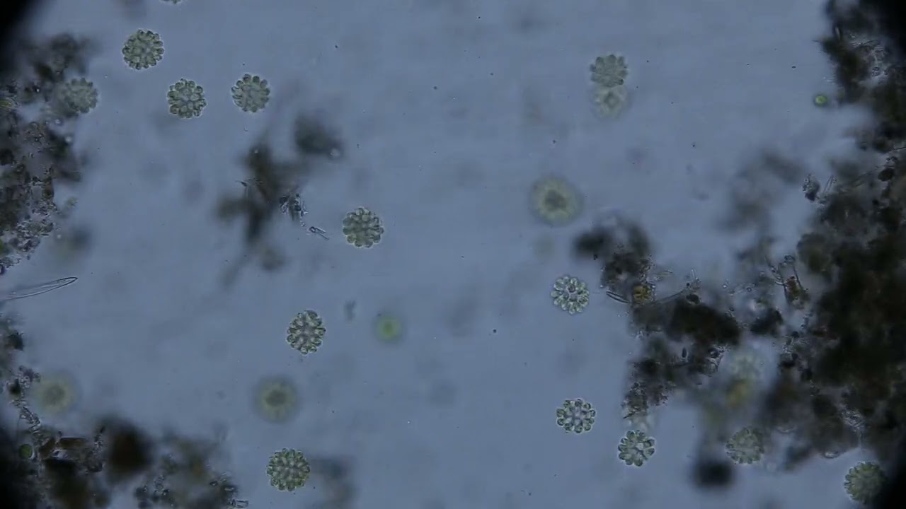 Synura, colonial golden algae
