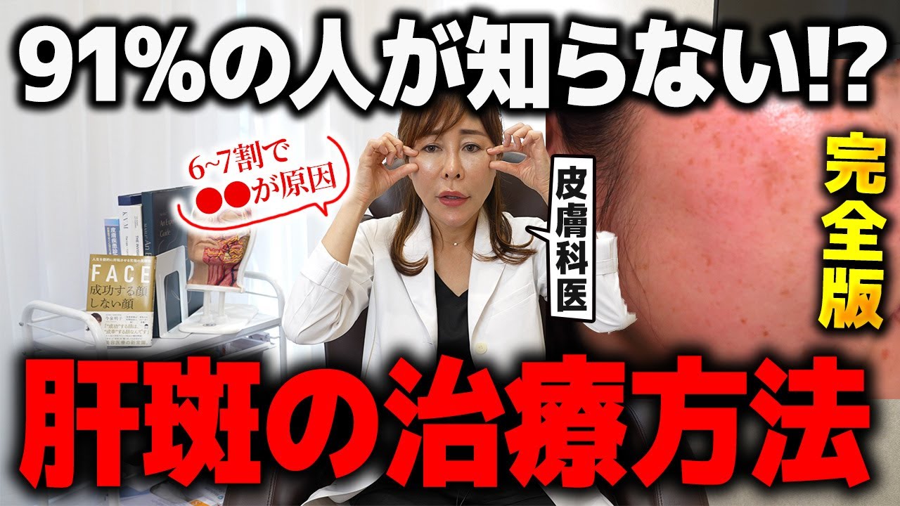 【肝斑】なんでこれやってないの? 91%の人が知らない肝斑の治療方法とは？【シミ治療】