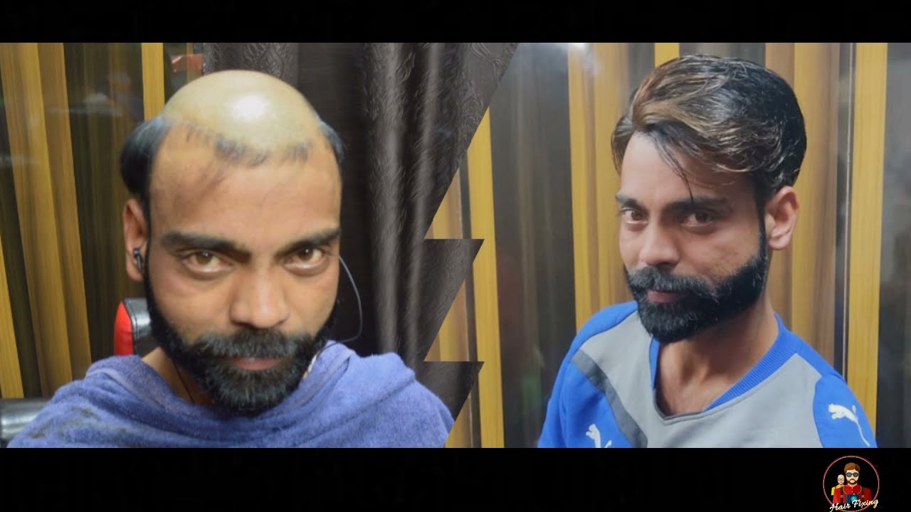 Best hair wig shop in chandigarh | Hair wig done by Perfection | 8544894476 | Affordable hair wigs