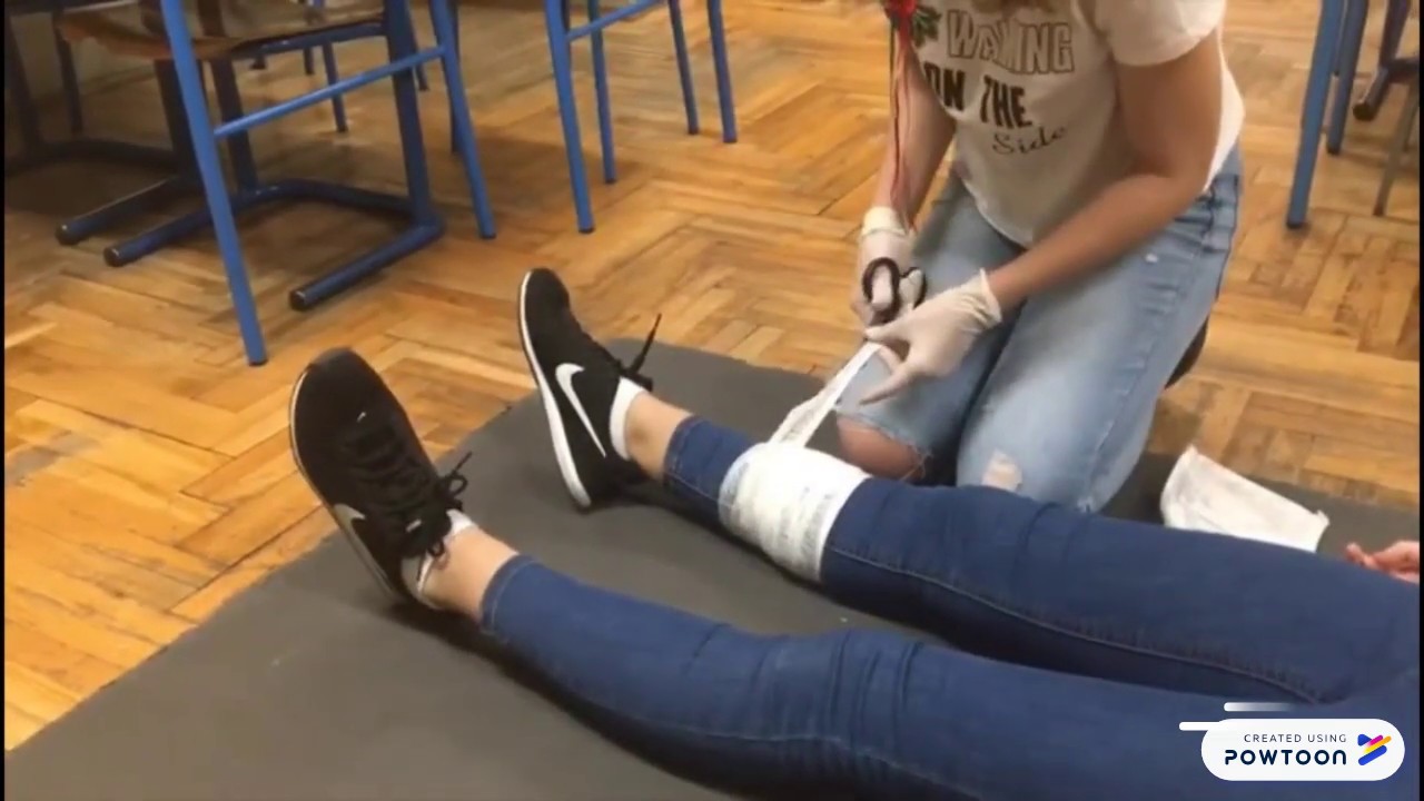 Zaustavljanje vanjskog krvarenja kompresivnim zavojem