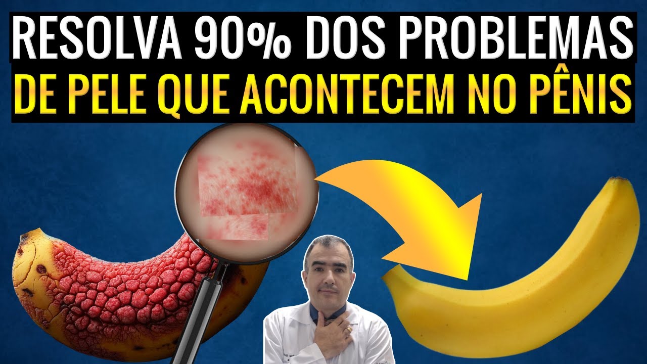 Resolva 90% dos problemas de pele que acontecem no pênis