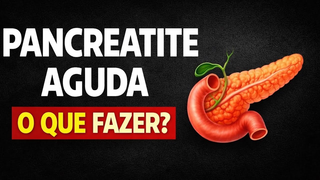 Pancreatite Aguda na Prática | Caso Clínico Comentado (Diagnóstico e Tratamento)