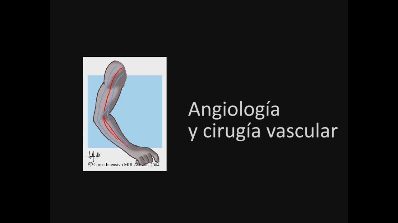 Angiolog&iacute;a y Cirug&iacute;a Vascular. Curso MIR Asturias