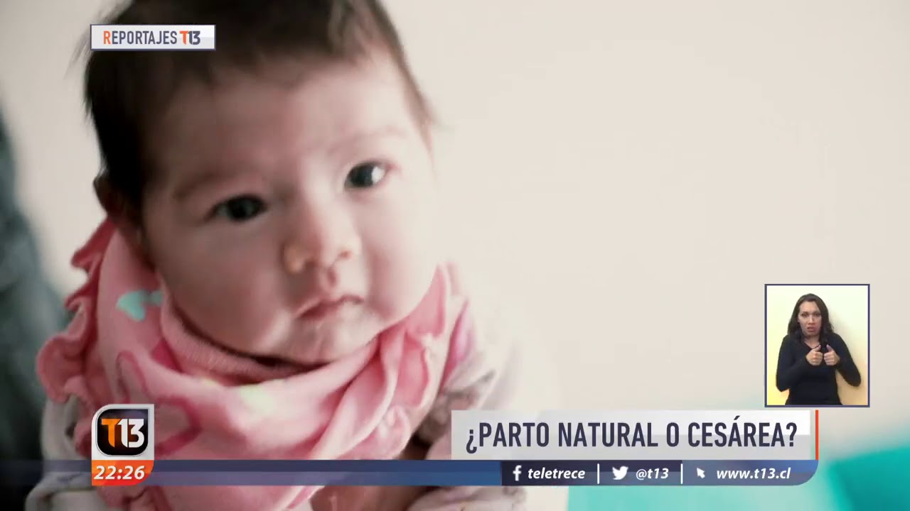 Reportajes T13 | ¿Parto normal o cesárea?