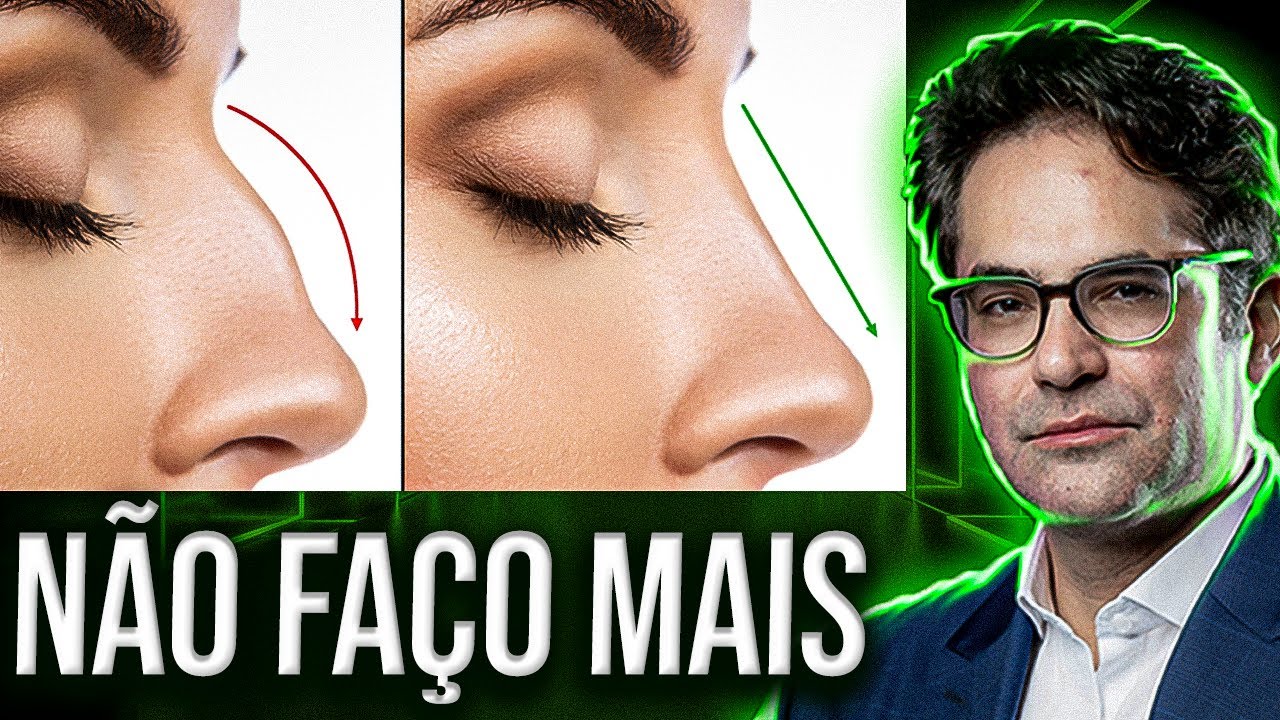 Por que eu não faço mais RINOPLASTIA?