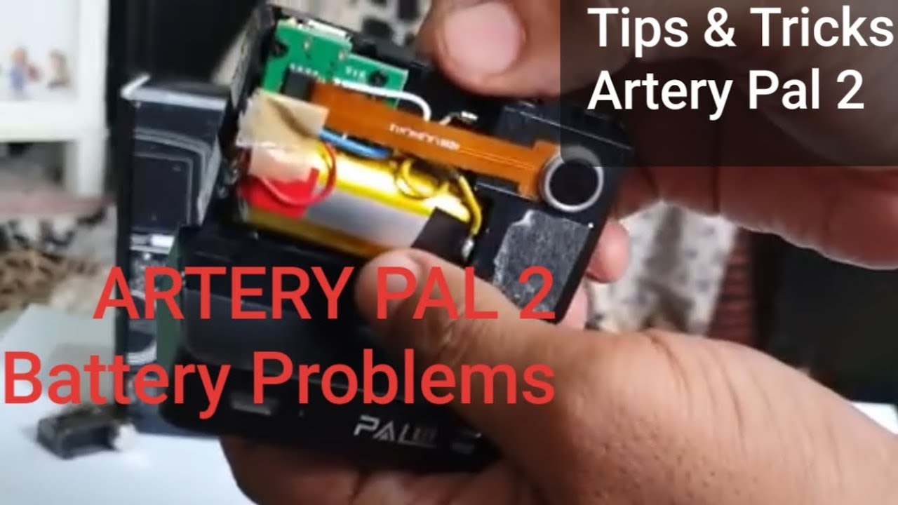 Repair Artery PAL 2 - Battery Charging Problems