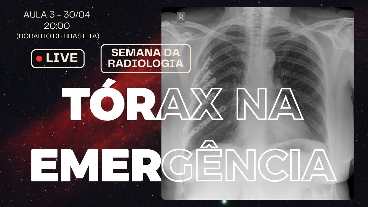 Tórax na Emergência