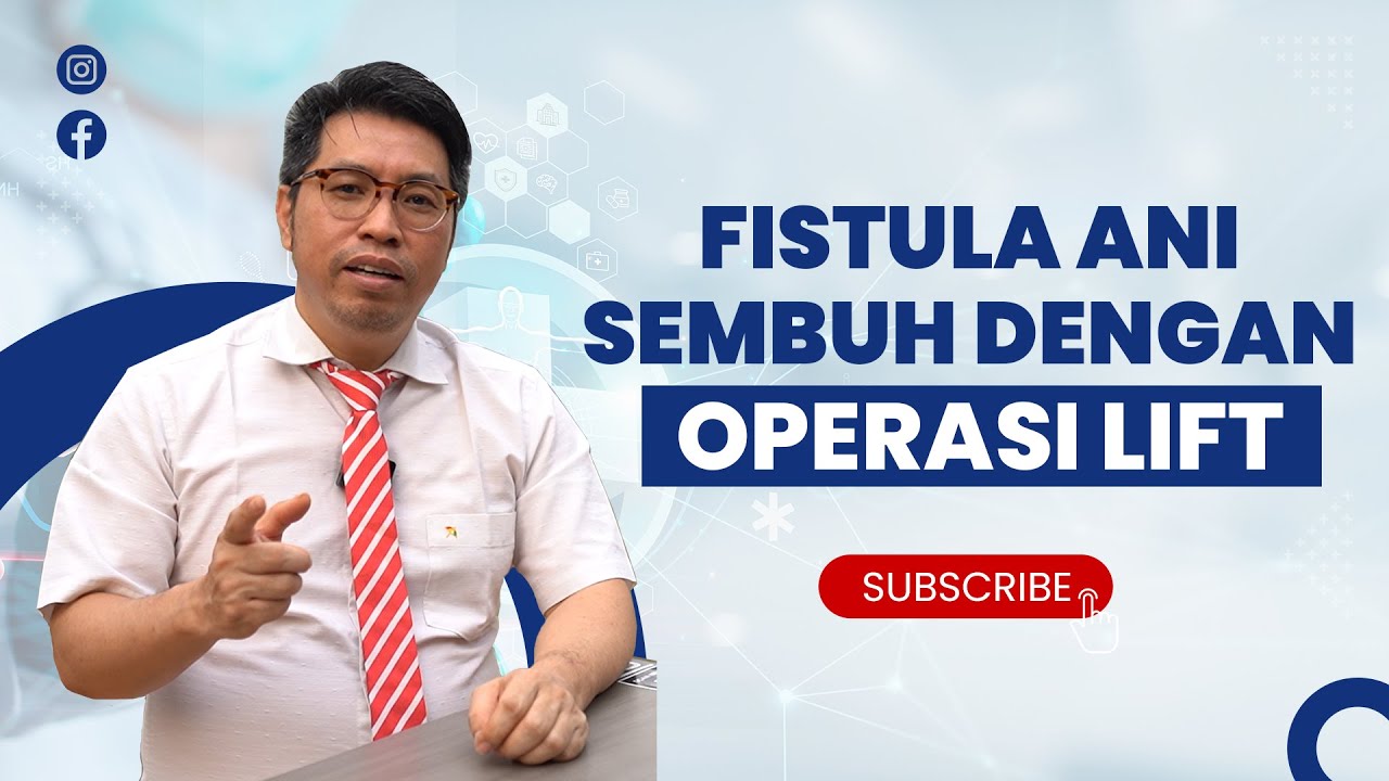 FISTULA ANI SEMBUH DENGAN OPERASI LIFT (Ligation of the Intersphincteric Fistula Tract)
