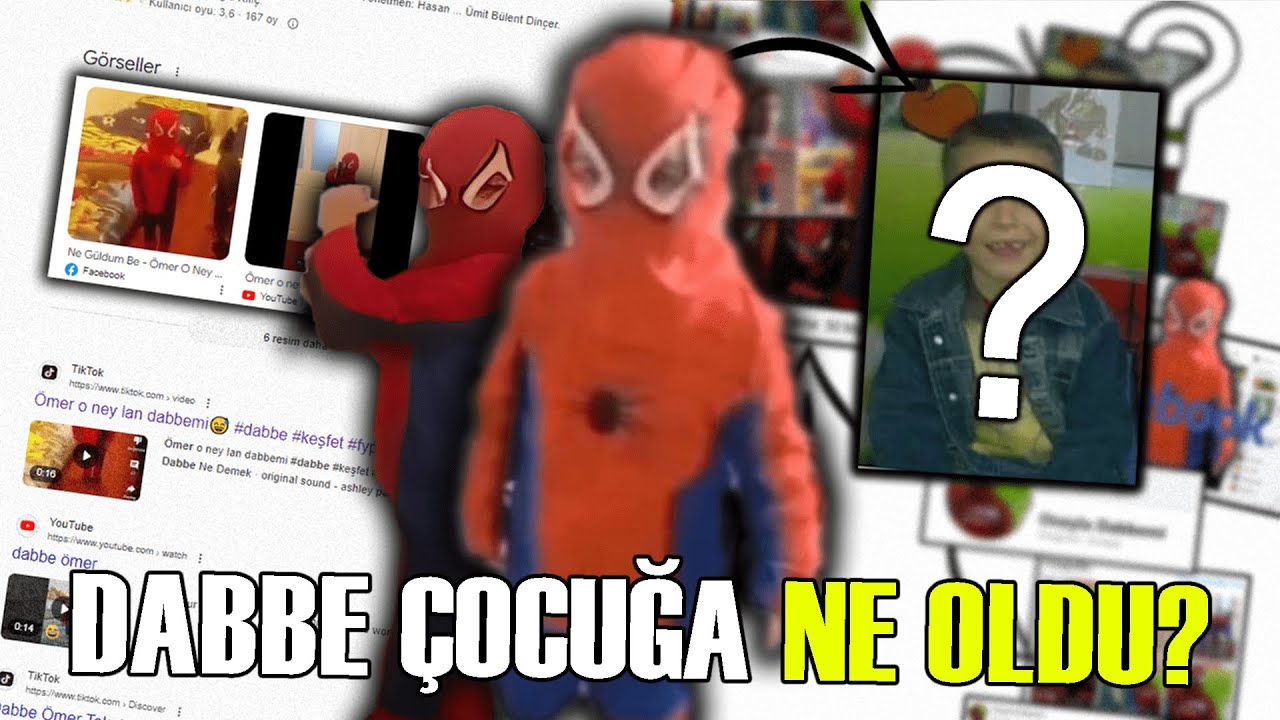 Dabbe Çocuğa Ne Oldu? (Ne Sandın Yar***m)