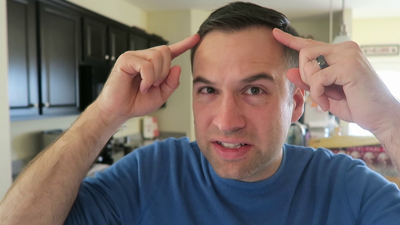 5 MORE Ways to Predict If You Will Go Bald (A Sequel)