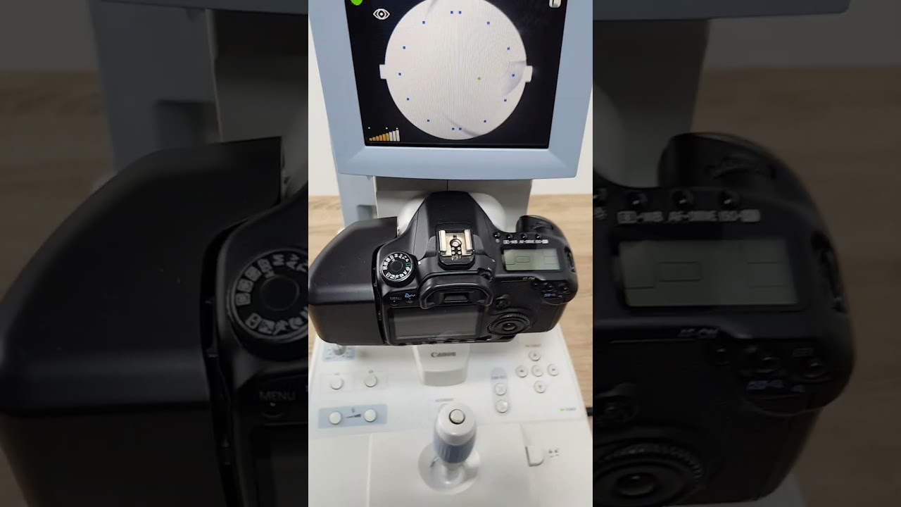 canon CR 1 retinal camera