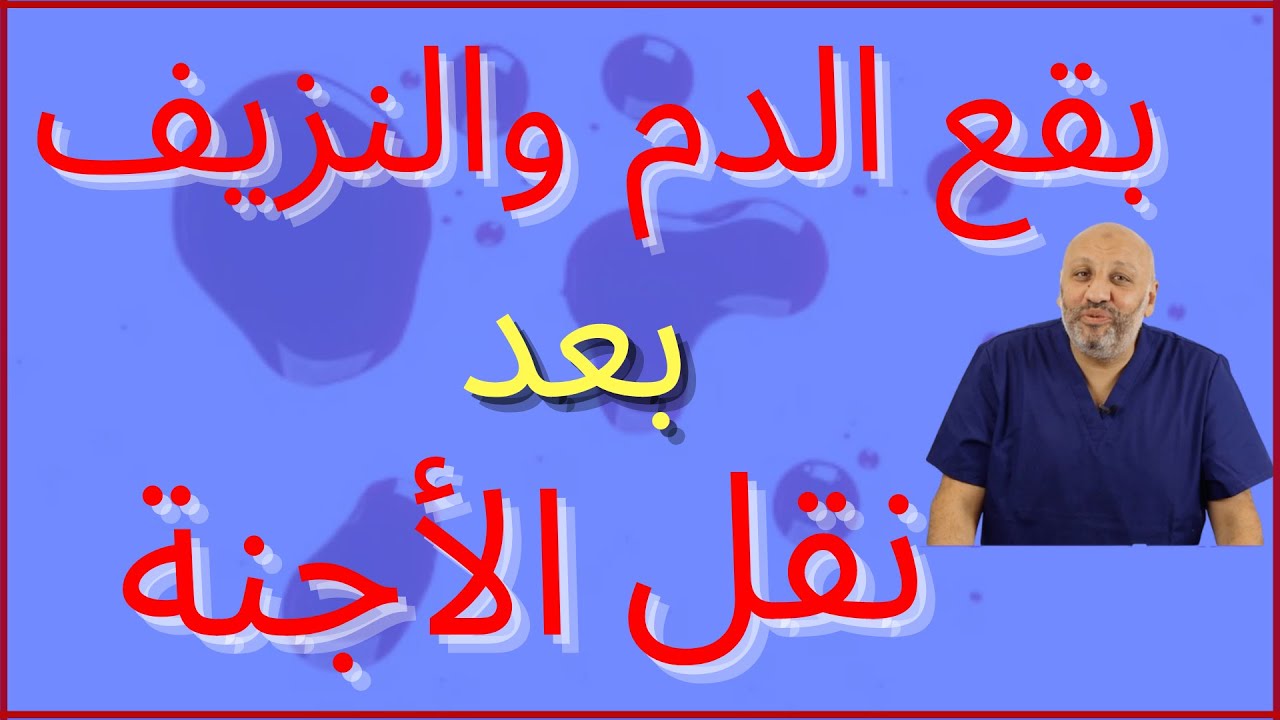صح او خطأ ( 36) هل بقع الدم أو النزيف الخفيف دليل علي حدوث الحمل ؟