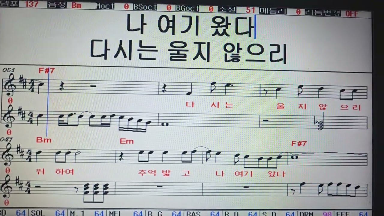 동전인생 진성 MR  Bm 앨프반주기808  