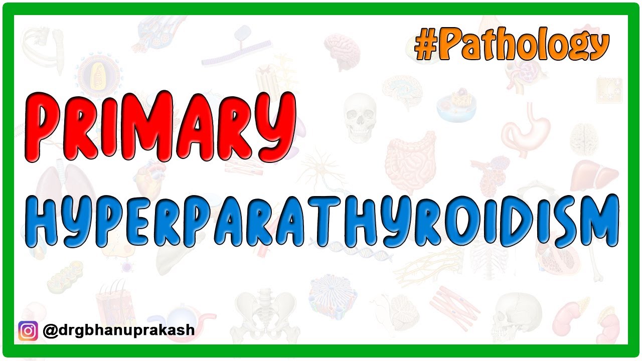 Primary Hyperparathyroidism - Etiology , Pathogenesis , Pathology , Diagnosis and Treatment