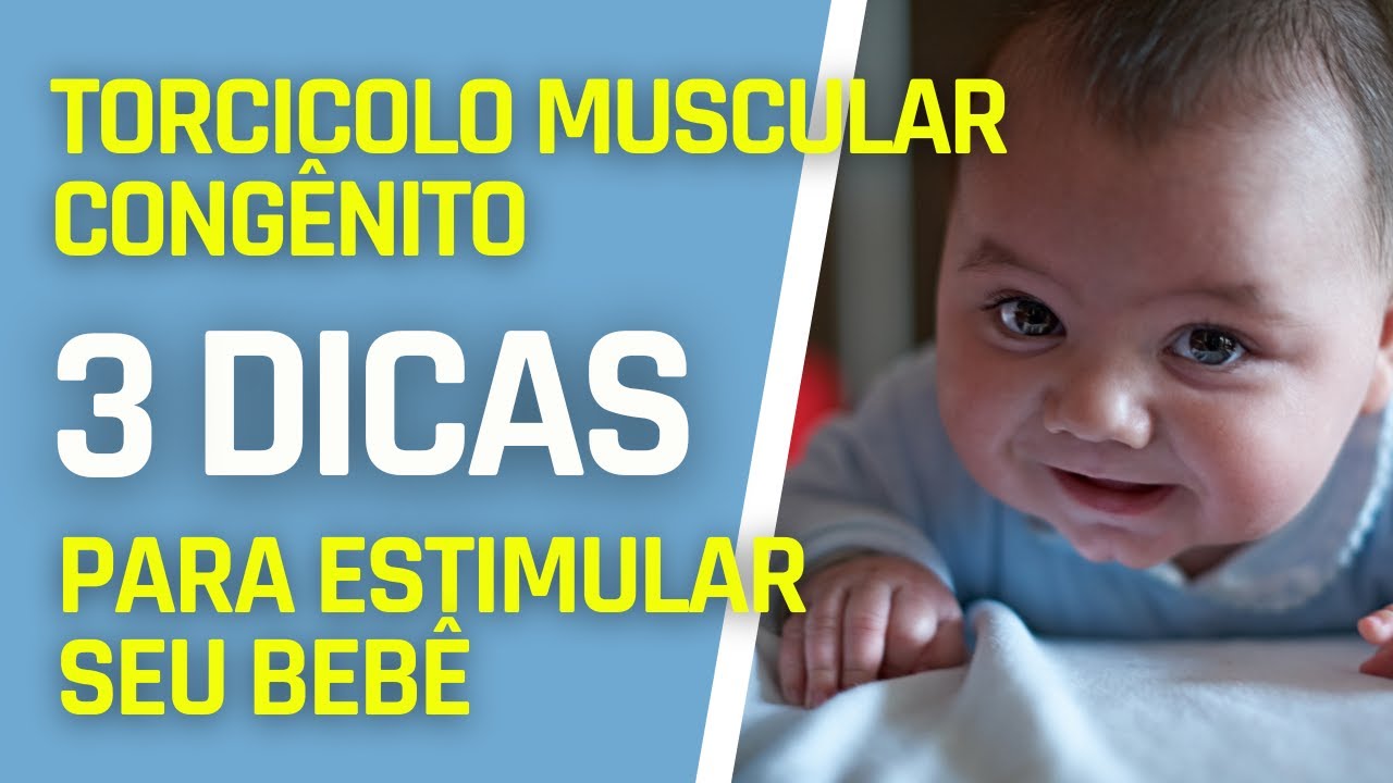 TORCICOLO MUSCULAR CONGÊNITO 3 DICAS PARA ESTIMULAR SEU BEBÊ EM CASA