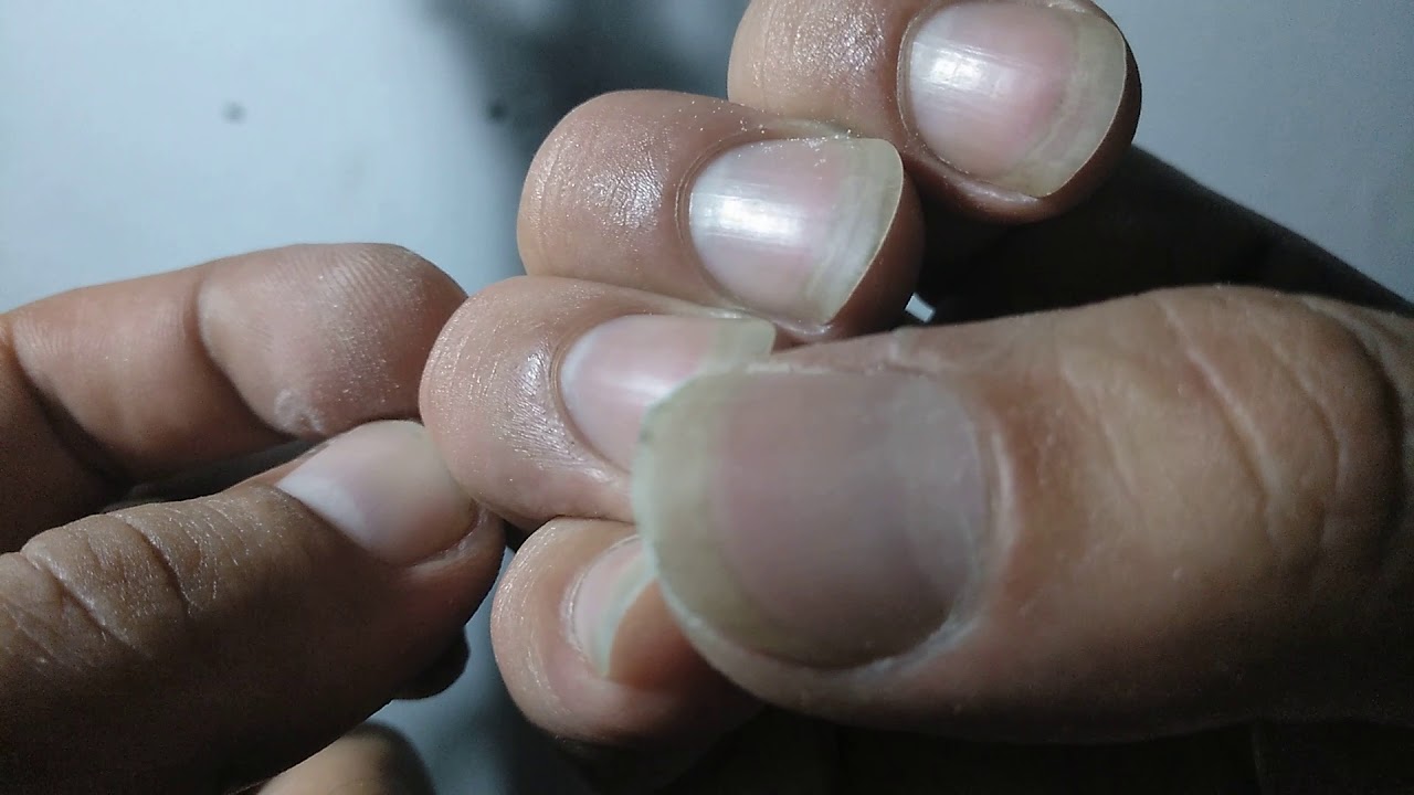 Consejo 2. ¿Como tener las uñas para tocar la guitarra?