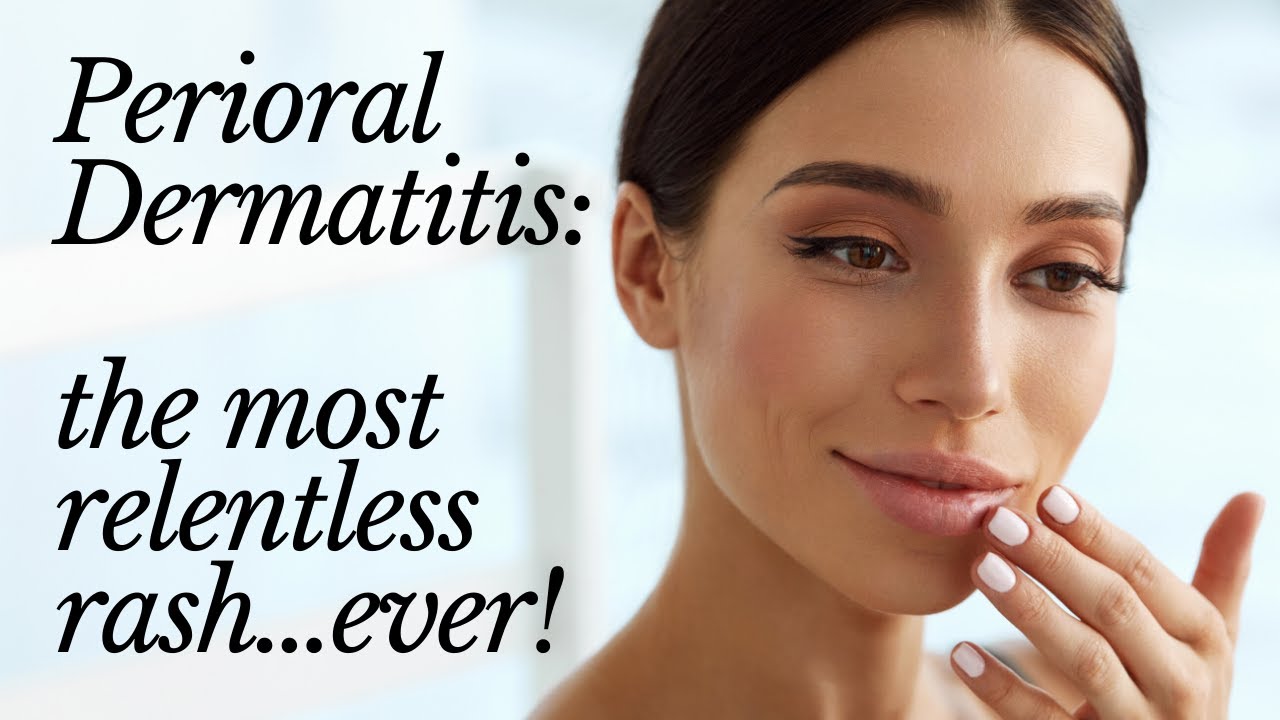 PERIORAL DERMATITIS: the most relentless rash...ever!